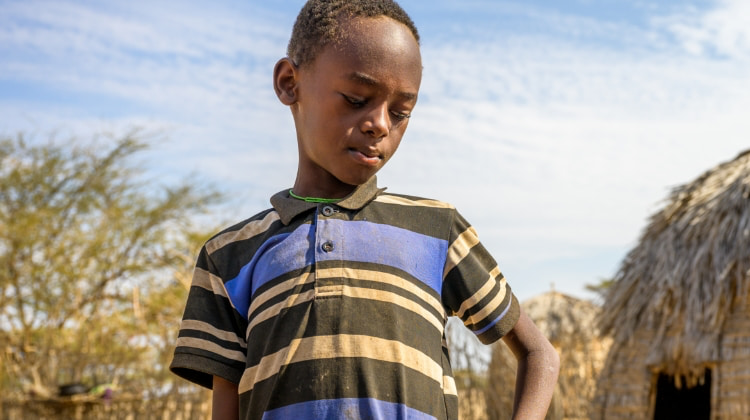 Malnourished African boy