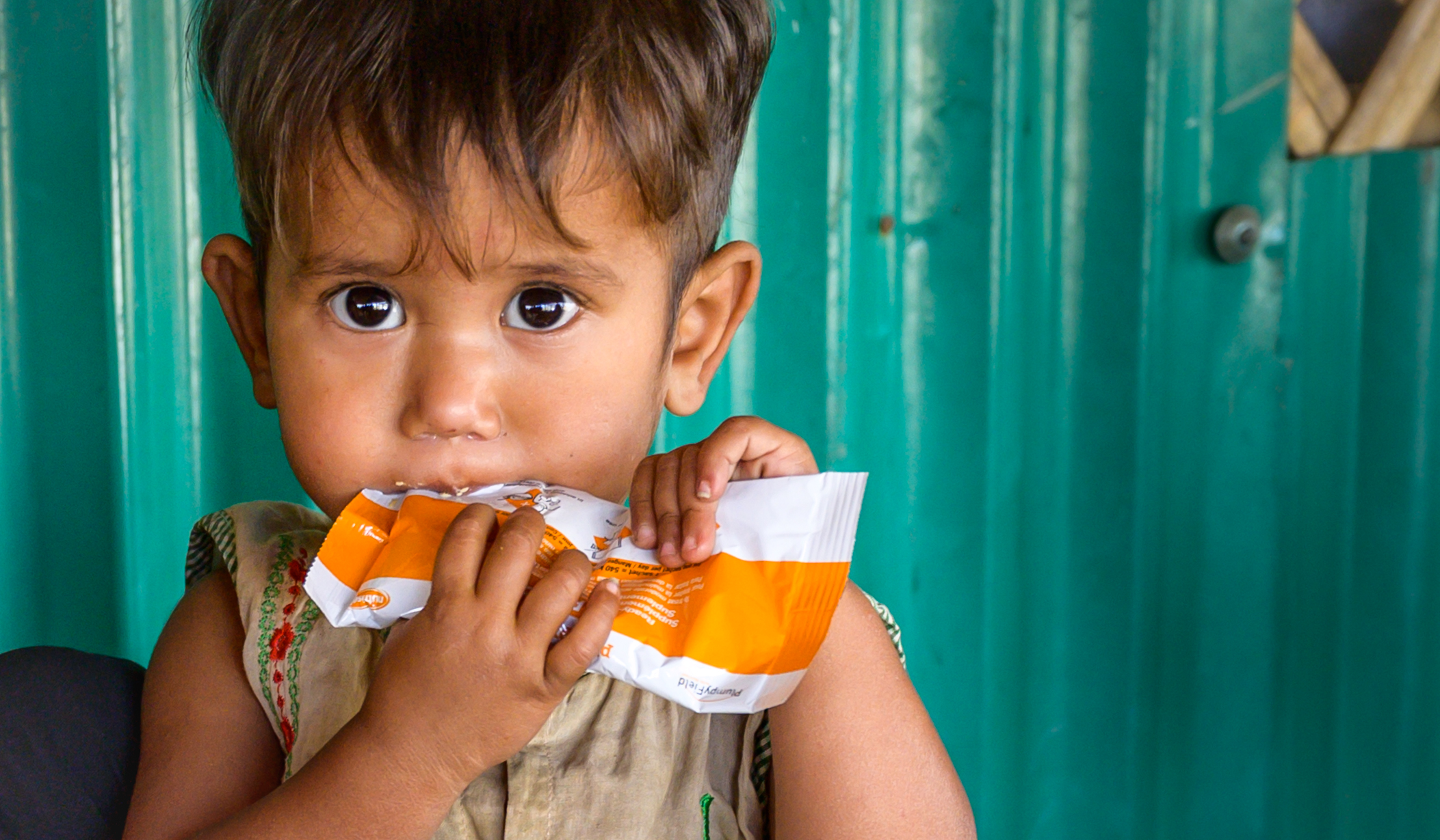 Children I Malnutrition I Refugee I Cox's Bazaar I Bangladesh