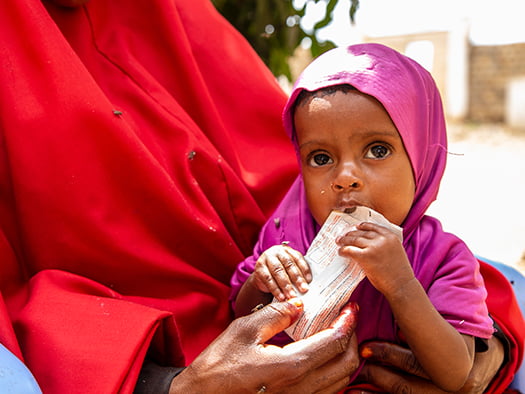 Baby Hamdi, 7 months, is recovering from severe malnutrition after receiving life-saving therapeutic food and treatment at a World Vision nutrition clinic in Baidoa, Somalia.