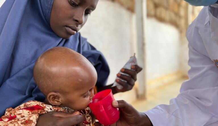 Malnourished child eating